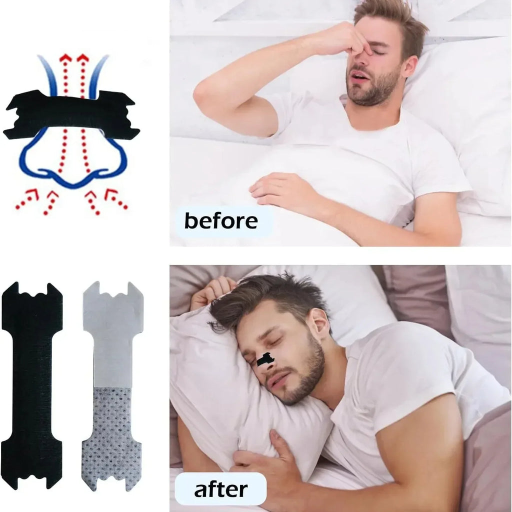 Tiras Nasales Respiratorias para Dormir - Pack 30/90/150 Unidades